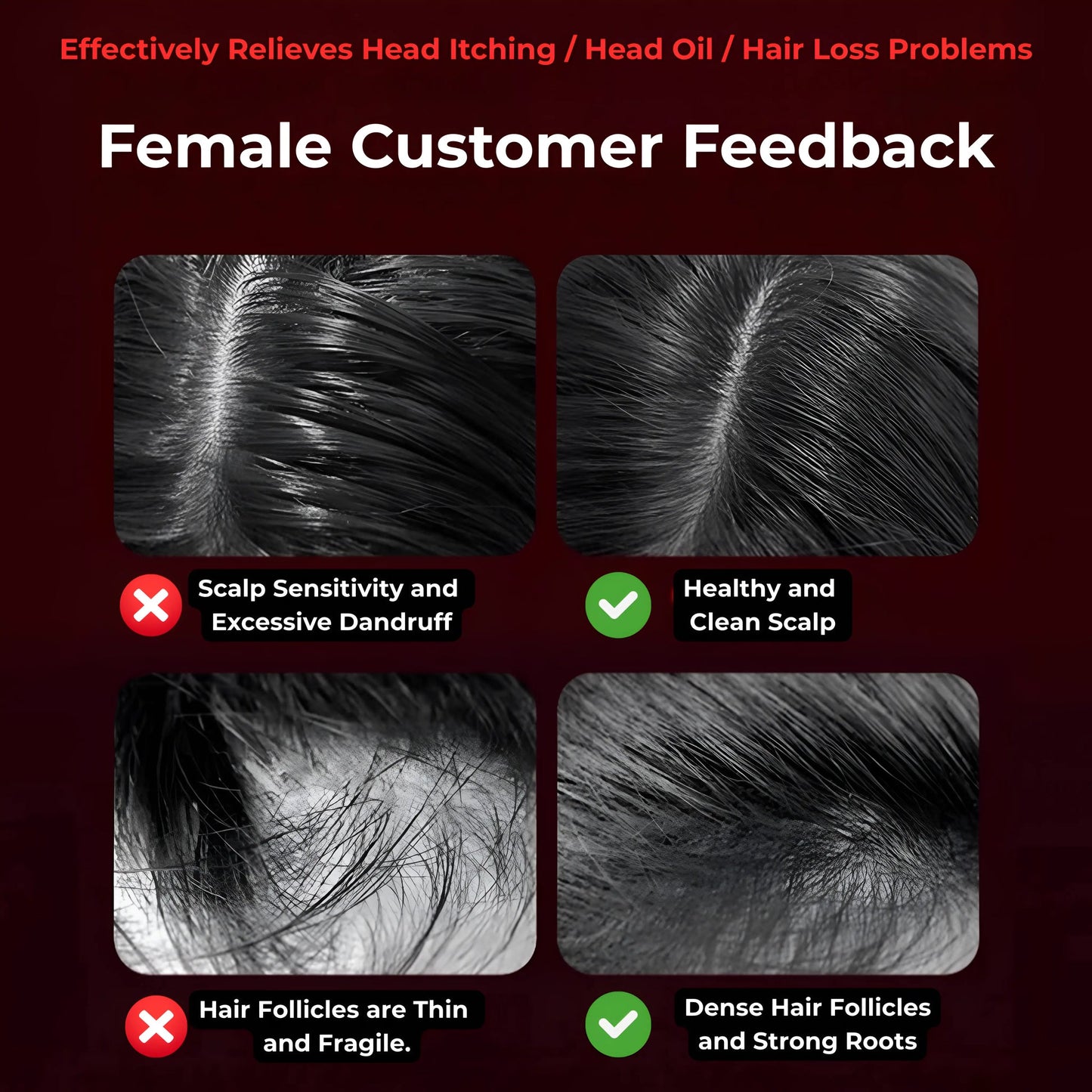 Scalp Pulse Pro | جهاز تحفيز فروة الرأس بالأشعة تحت الحمراء