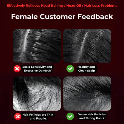 Scalp Pulse Pro | جهاز تحفيز فروة الرأس بالأشعة تحت الحمراء